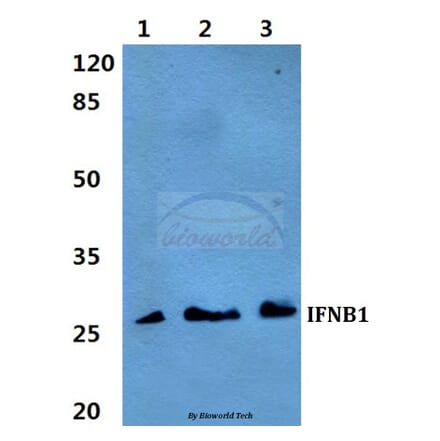 Anti-IFNB1 Antibody from Bioworld Technology (BS60295) - Antibodies.com