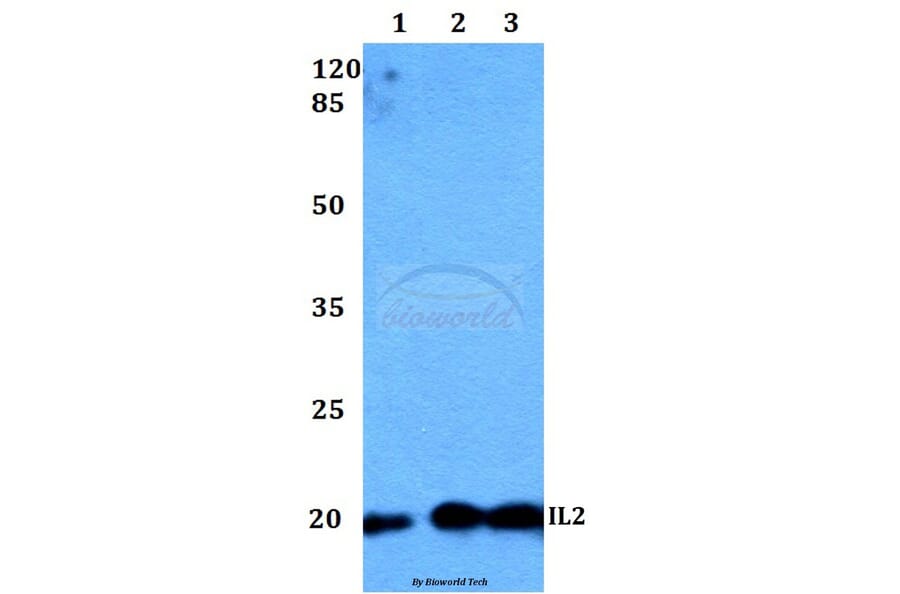 Anti-IL2 Antibody from Bioworld Technology (BS60299) - Antibodies.com