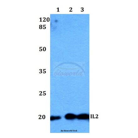 Anti-IL2 Antibody from Bioworld Technology (BS60299) - Antibodies.com