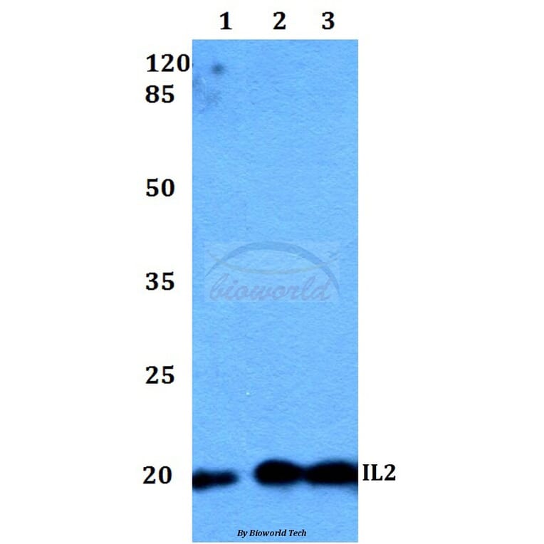 Anti-IL2 Antibody from Bioworld Technology (BS60299) - Antibodies.com