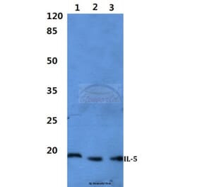 Anti-IL-5 Antibody from Bioworld Technology (BS60300) - Antibodies.com