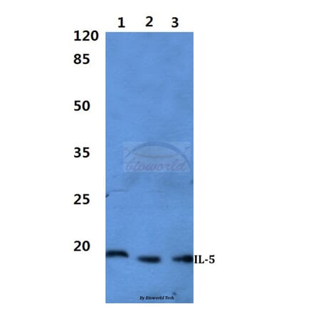 Anti-IL-5 Antibody from Bioworld Technology (BS60300) - Antibodies.com