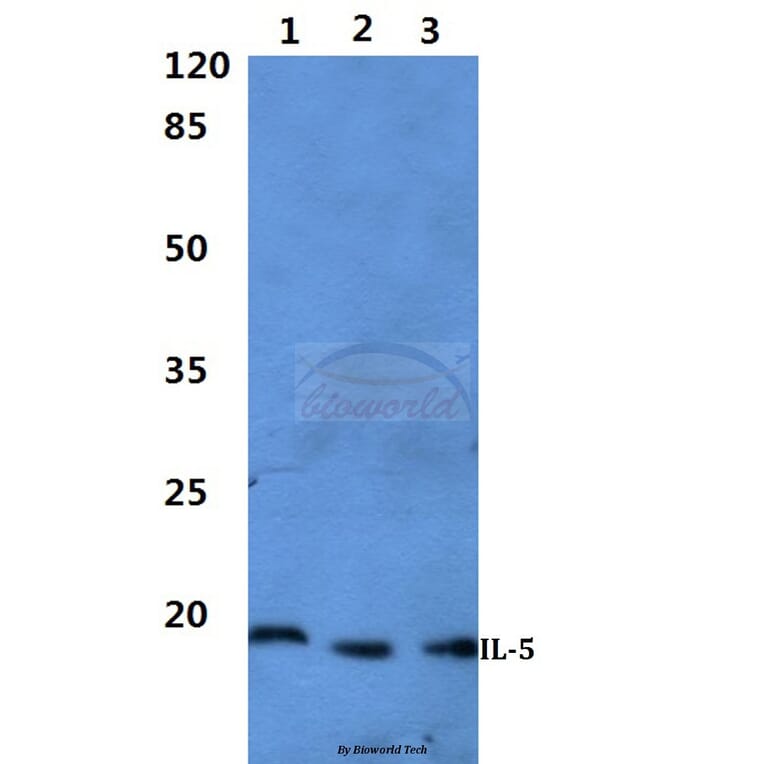 Anti-IL-5 Antibody from Bioworld Technology (BS60300) - Antibodies.com