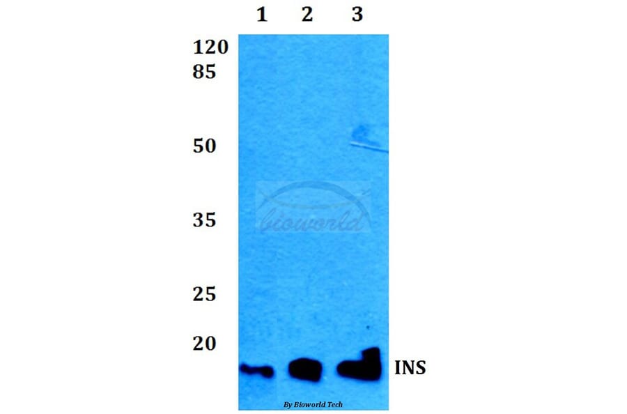 Anti-Insulin Antibody from Bioworld Technology (BS60301) - Antibodies.com