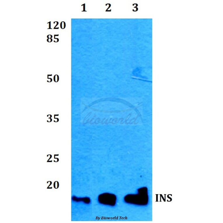 Anti-Insulin Antibody from Bioworld Technology (BS60301) - Antibodies.com