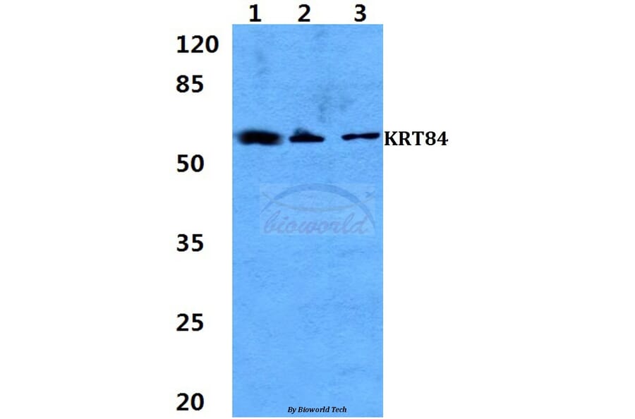 Anti-Cytokeratin 84 Antibody from Bioworld Technology (BS60302) - Antibodies.com