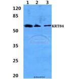 Anti-Cytokeratin 84 Antibody from Bioworld Technology (BS60302) - Antibodies.com
