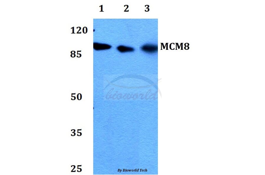 Anti-MCM8 Antibody from Bioworld Technology (BS60306) - Antibodies.com
