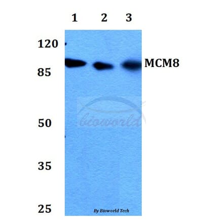 Anti-MCM8 Antibody from Bioworld Technology (BS60306) - Antibodies.com