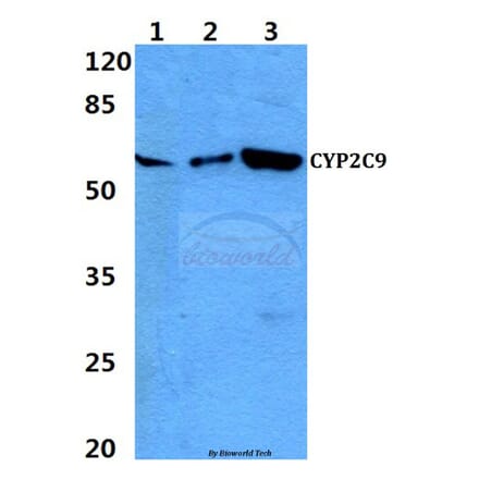 Anti-CYP2C9 Antibody from Bioworld Technology (BS60309) - Antibodies.com