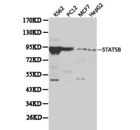 Anti-Stat5b Antibody from Bioworld Technology (BS6031) - Antibodies.com