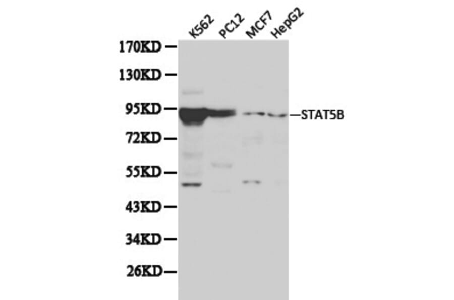 Anti-Stat5b Antibody from Bioworld Technology (BS6031) - Antibodies.com