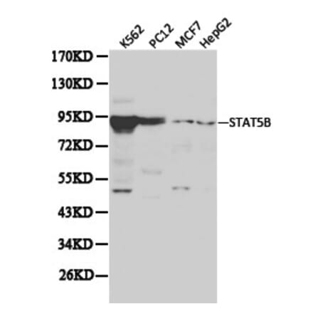 Anti-Stat5b Antibody from Bioworld Technology (BS6031) - Antibodies.com