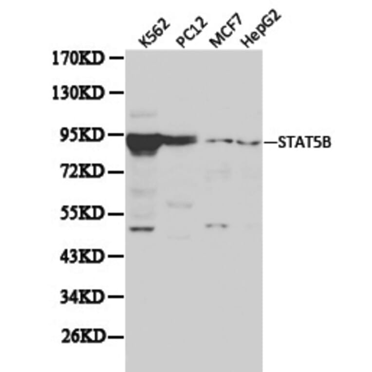 Anti-Stat5b Antibody from Bioworld Technology (BS6031) - Antibodies.com