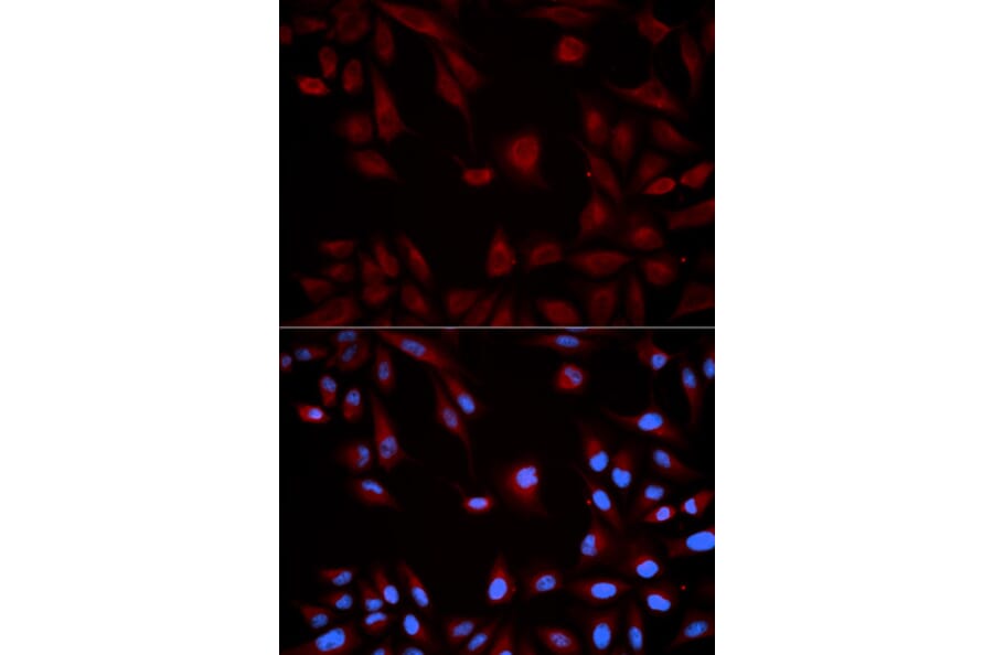 Anti-Stat5b Antibody from Bioworld Technology (BS6031) - Antibodies.com