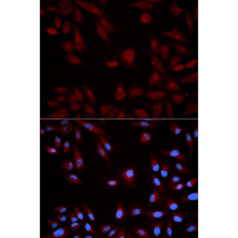 Anti-Stat5b Antibody from Bioworld Technology (BS6031) - Antibodies.com