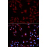 Anti-Stat5b Antibody from Bioworld Technology (BS6031) - Antibodies.com