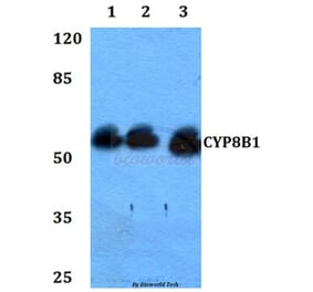 Anti-CYP8B1 Antibody from Bioworld Technology (BS60310) - Antibodies.com
