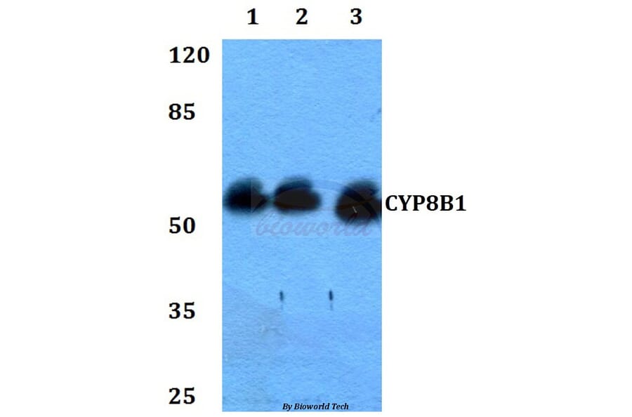 Anti-CYP8B1 Antibody from Bioworld Technology (BS60310) - Antibodies.com