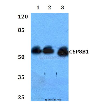 Anti-CYP8B1 Antibody from Bioworld Technology (BS60310) - Antibodies.com