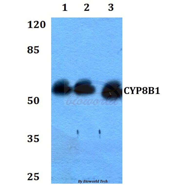 Anti-CYP8B1 Antibody from Bioworld Technology (BS60310) - Antibodies.com
