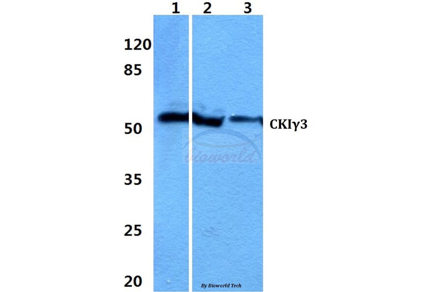 Anti-Casein Kinase Iγ3 Antibody from Bioworld Technology (BS60318) - Antibodies.com
