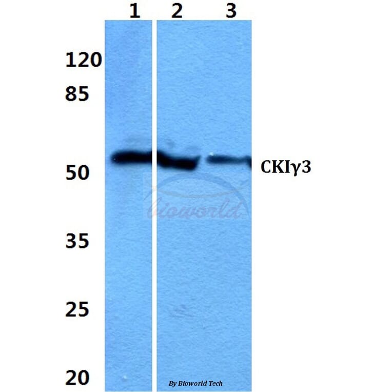 Anti-Casein Kinase Iγ3 Antibody from Bioworld Technology (BS60318) - Antibodies.com