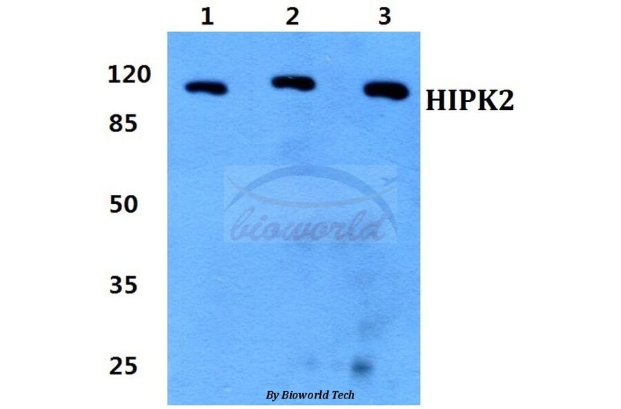 Anti-HIPK2 Antibody from Bioworld Technology (BS60320) - Antibodies.com