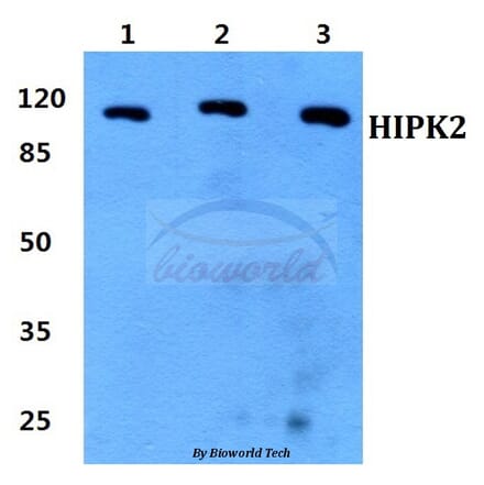 Anti-HIPK2 Antibody from Bioworld Technology (BS60320) - Antibodies.com