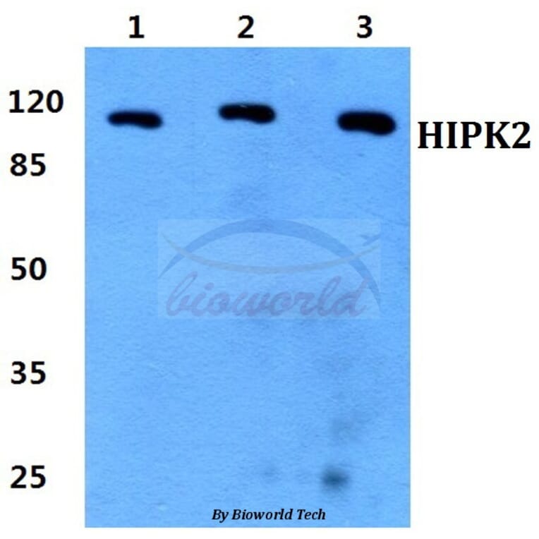 Anti-HIPK2 Antibody from Bioworld Technology (BS60320) - Antibodies.com