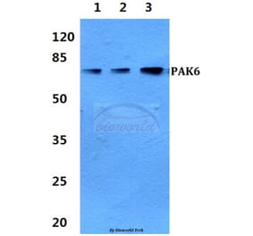 Anti-PAK6 Antibody from Bioworld Technology (BS60321) - Antibodies.com