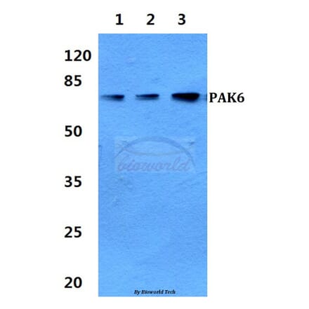 Anti-PAK6 Antibody from Bioworld Technology (BS60321) - Antibodies.com