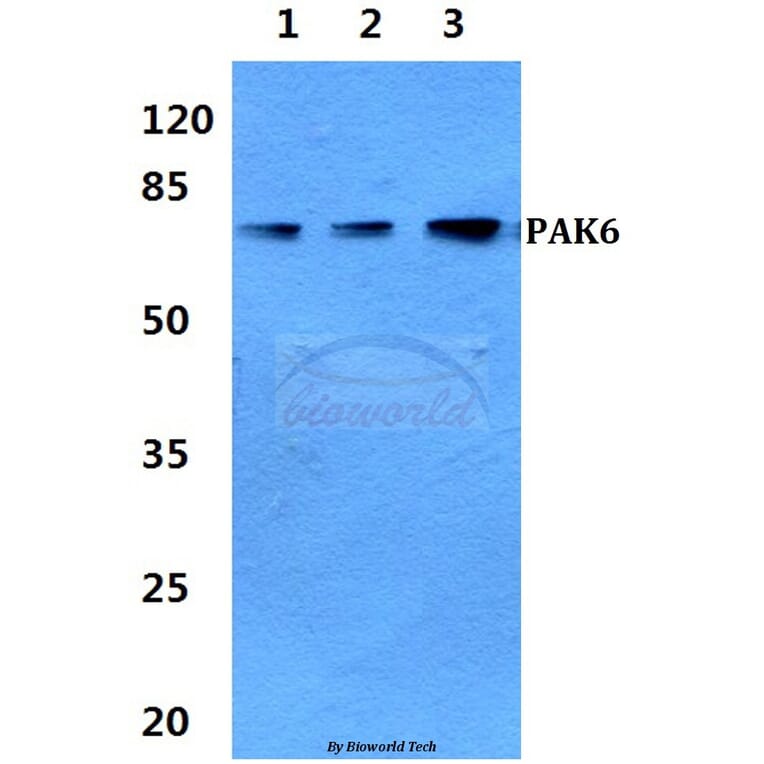 Anti-PAK6 Antibody from Bioworld Technology (BS60321) - Antibodies.com