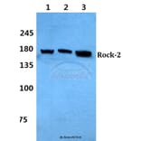 Anti-Rock2 Antibody from Bioworld Technology (BS60322) - Antibodies.com