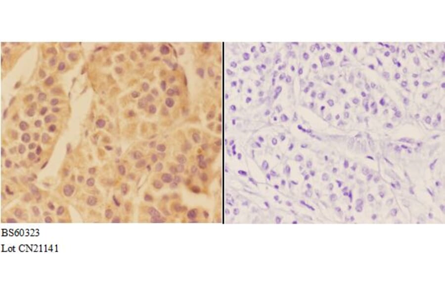 Anti-APOA1 Antibody from Bioworld Technology (BS60323) - Antibodies.com