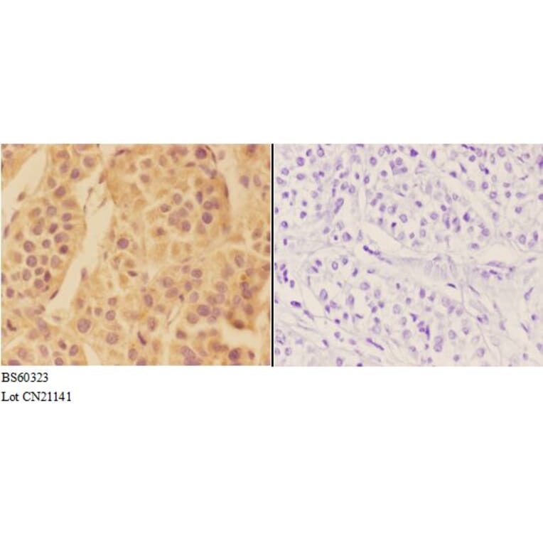 Anti-APOA1 Antibody from Bioworld Technology (BS60323) - Antibodies.com