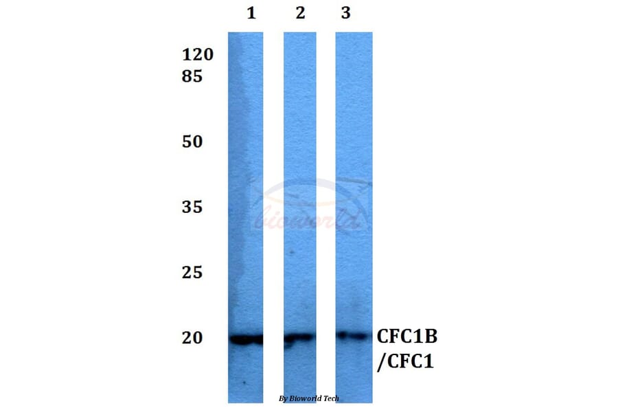 Anti-CFC1B/CFC1 Antibody from Bioworld Technology (BS60336) - Antibodies.com