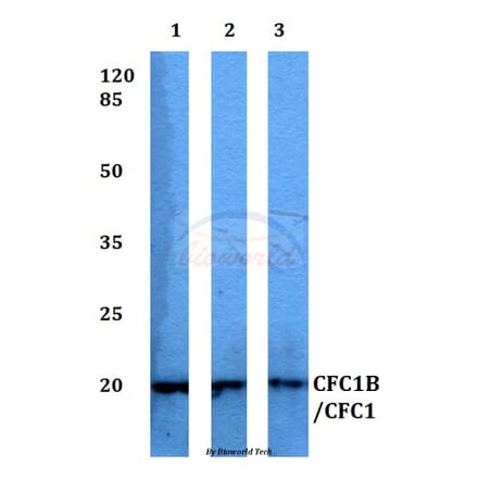 Anti-CFC1B/CFC1 Antibody from Bioworld Technology (BS60336) - Antibodies.com
