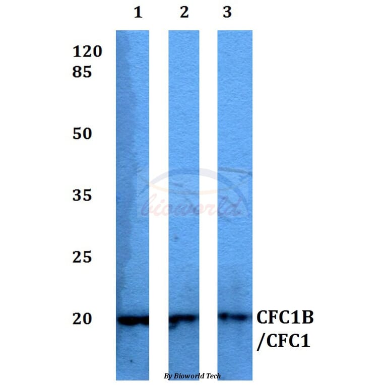 Anti-CFC1B/CFC1 Antibody from Bioworld Technology (BS60336) - Antibodies.com