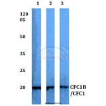 Anti-CFC1B/CFC1 Antibody from Bioworld Technology (BS60336) - Antibodies.com