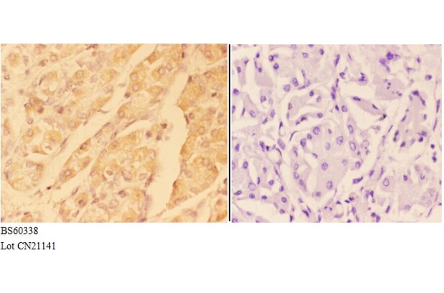 Anti-ADAM10 Antibody from Bioworld Technology (BS60338) - Antibodies.com