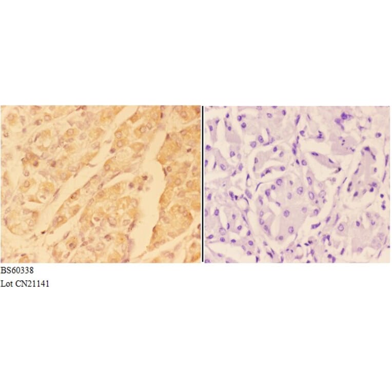 Anti-ADAM10 Antibody from Bioworld Technology (BS60338) - Antibodies.com