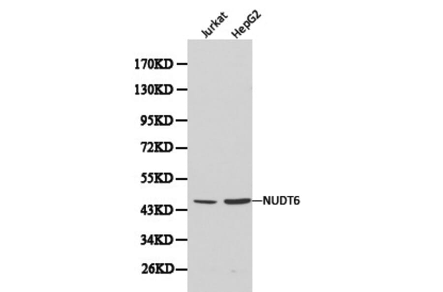 Anti-NUDT6 Antibody from Bioworld Technology (BS6034) - Antibodies.com