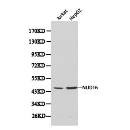 Anti-NUDT6 Antibody from Bioworld Technology (BS6034) - Antibodies.com