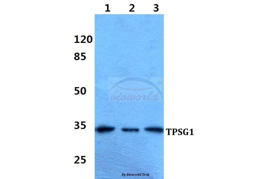 Anti-TPSG1 Antibody from Bioworld Technology (BS60344) - Antibodies.com