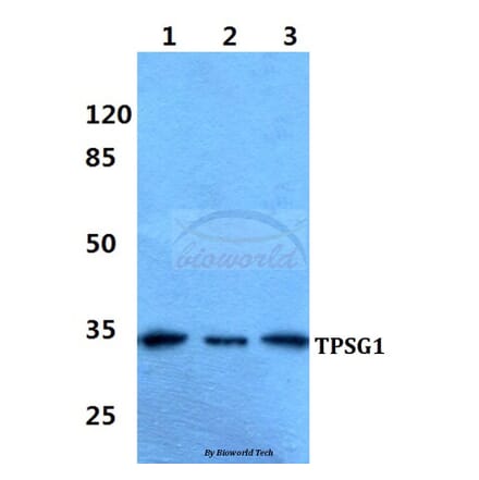 Anti-TPSG1 Antibody from Bioworld Technology (BS60344) - Antibodies.com