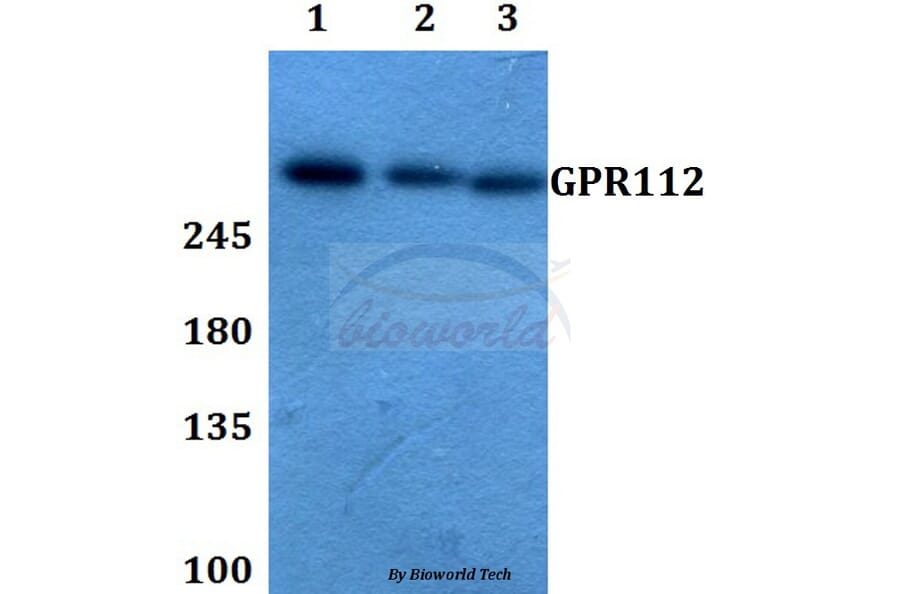 Anti-GPR112 Antibody from Bioworld Technology (BS60350) - Antibodies.com