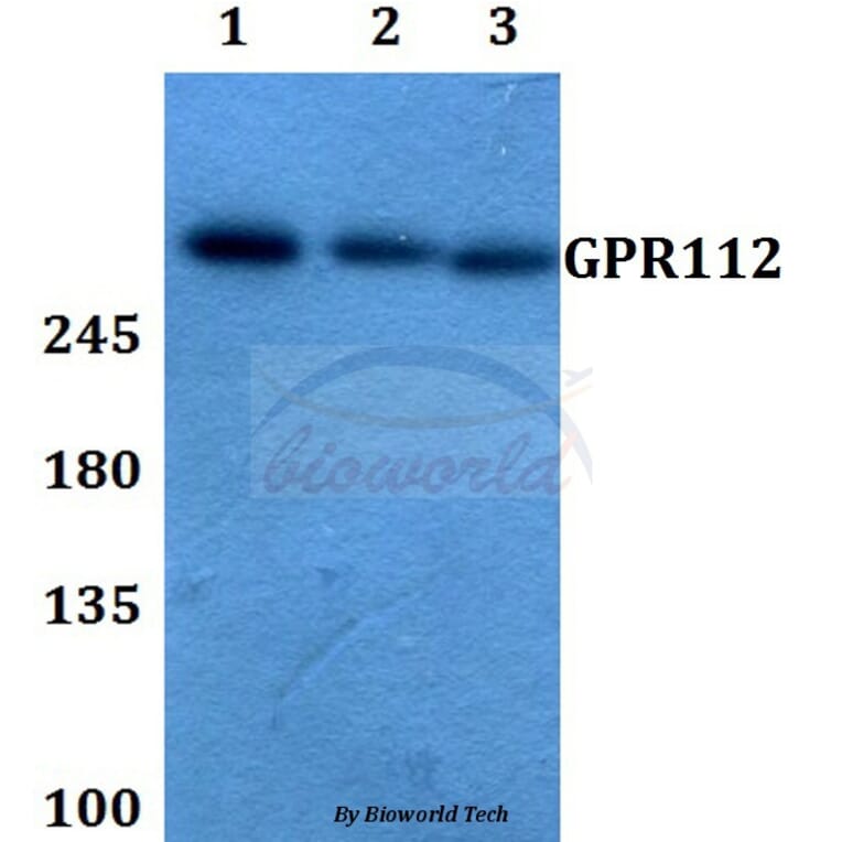 Anti-GPR112 Antibody from Bioworld Technology (BS60350) - Antibodies.com
