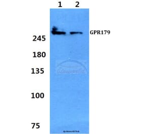Anti-GPR179 Antibody from Bioworld Technology (BS60352) - Antibodies.com