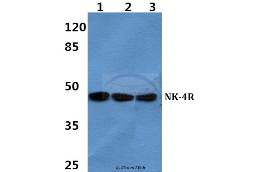 Anti-NK-4R Antibody from Bioworld Technology (BS60354) - Antibodies.com